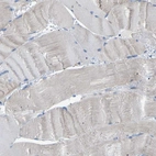 Immunohistochemical staining of human skeletal muscle shows low expression as expected.