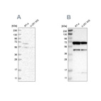 Anti-CROT Antibody