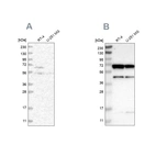 Western blot analysis using Anti-CROT antibody HPA019364 (A) shows similar pattern to independent antibody HPA019365 (B).