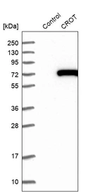 Western blot analysis in control (vector only transfected HEK293T lysate) and CROT over-expression lysate (Co-expressed with a C-terminal myc-DDK tag (~3.1 kDa) in mammalian HEK293T cells, LY412059).