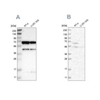 Anti-CROT Antibody