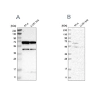 Western blot analysis using Anti-CROT antibody HPA019365 (A) shows similar pattern to independent antibody HPA019364 (B).