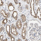 Immunohistochemical staining of human kidney shows moderate cytoplasmic positivity in cells in tubules.