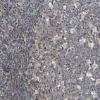 Immunohistochemical staining of human tonsil shows strong cytoplasmic positivity in a subset of germinal center cells.