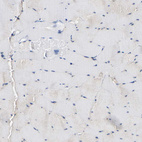 Immunohistochemical staining of human skeletal muscle shows no positivity in myocytes as expected.