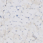 Anti-LRBA Antibody