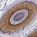 Anti-KRT75 Antibody