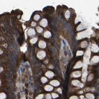 Immunohistochemical staining of human colon using Anti-GCC1 antibody HPA019369.