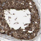 Immunohistochemical staining of human testis using Anti-GCC1 antibody HPA019369.