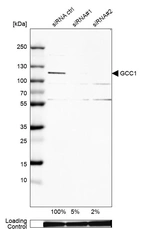 Western blot analysis in U-138MG cells transfected with control siRNA, target specific siRNA probe #1 and #2, using Anti-GCC1 antibody. Remaining relative intensity is presented. Loading control: Anti-GAPDH.