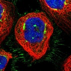 Immunofluorescent staining of human cell line A-431 shows localization to plasma membrane, cytosol & the Golgi apparatus.