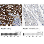 Anti-ACO1 Antibody