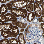 Immunohistochemical staining of human kidney shows strong cytoplasmic positivity in cells in tubules.