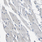 Anti-ACO1 Antibody