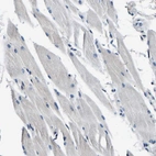 Immunohistochemical staining of human skeletal muscle shows no positivity in myocytes as expected.