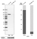 Western blot analysis in human cell lines U2OS and SK-MEL-30 using Anti-ACO1 antibody. Corresponding ACO1 RNA-seq data are presented for the same cell lines. Loading control: Anti-PPIB.