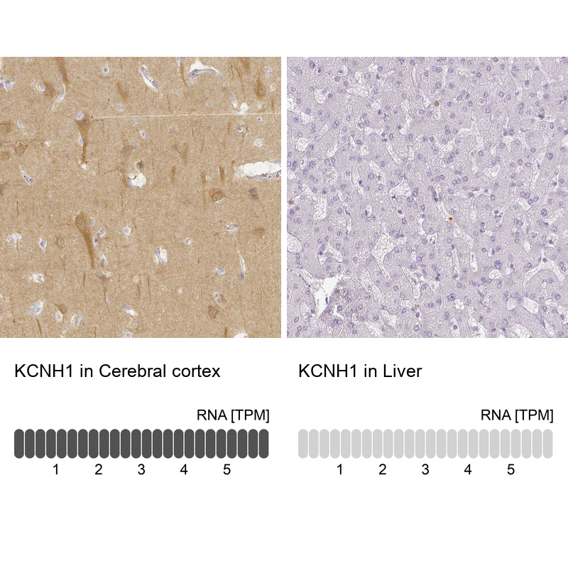 Anti-KCNH1 Antibody
