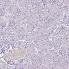 Immunohistochemical staining of human pancreas shows no positivity in exocrine glandular cells, as expected.