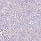 Immunohistochemical staining of human pancreas shows no positivity in exocrine glandular cells, as expected.