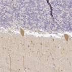 Immunohistochemical staining of human cerebellum shows moderate cytoplasmic positivity in Purkinje cells.