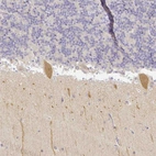 Immunohistochemical staining of human cerebellum shows moderate cytoplasmic positivity in Purkinje cells.