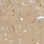 Immunohistochemical staining of human cerebral cortex shows moderate cytoplasmic positivity in neurons.