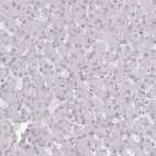 Immunohistochemical staining of human liver shows no positivity in hepatocytes, as expected.