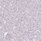 Immunohistochemical staining of human liver shows no positivity in hepatocytes, as expected.