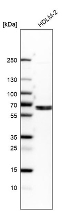 Western blot analysis in human cell line HDLM-2.