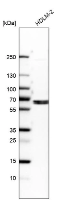Western blot analysis in human cell line HDLM-2.