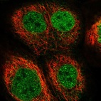 Immunofluorescent staining of human cell line A-431 shows localization to nucleoplasm & nuclear membrane.