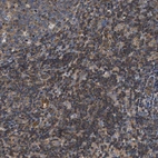 Immunohistochemical staining of human lymph node shows moderate cytoplasmic positivity in non-germinal center cells.