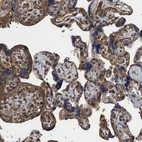 Immunohistochemical staining of human placenta shows strong granular cytoplasmic positivity in trophoblastic cells.