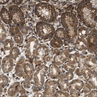 Immunohistochemical staining of human stomach shows moderate cytoplasmic positivity in glandular cells.