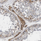 Immunohistochemical staining of human testis shows moderate cytoplasmic positivity in Leydig cells.