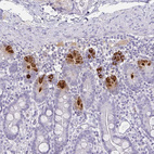 Immunohistochemical staining of human small intestine shows strong cytoplasmic positivity in Paneth cells.