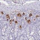 Immunohistochemical staining of human small intestine shows strong cytoplasmic positivity in Paneth cells.