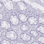 Immunohistochemical staining of human rectum shows no positivity in glandular cells as expected.