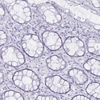 Immunohistochemical staining of human rectum shows no positivity in glandular cells as expected.