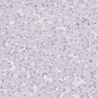 Immunohistochemical staining of human liver shows no cytoplasmic positivity in hepatocytes as expected.