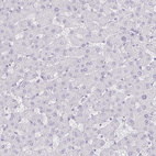 Anti-DEFA6 Antibody