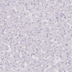 Immunohistochemical staining of human liver shows no cytoplasmic positivity in hepatocytes as expected.