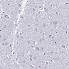 Immunohistochemical staining of human cerebral cortex shows no cytoplasmic positivity in neuronal cells as expected.