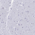 Immunohistochemical staining of human cerebral cortex shows no cytoplasmic positivity in neuronal cells as expected.