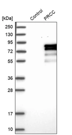 Western blot analysis in control (vector only transfected HEK293T lysate) and PRCC over-expression lysate (Co-expressed with a C-terminal myc-DDK tag (~3.1 kDa) in mammalian HEK293T cells, LY416956).