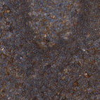 Immunohistochemical staining of human lymph node shows strong cytoplasmic positivity in non-germinal center cells.