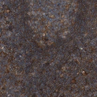 Immunohistochemical staining of human lymph node shows strong cytoplasmic positivity in non-germinal center cells.