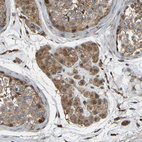 Immunohistochemical staining of human testis shows moderate cytoplasmic positivity in Leydig cells.