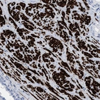 Immunohistochemical staining of human prostate shows strong cytoplasmic positivity in smooth muscle cells.