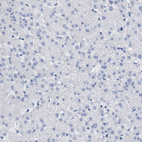Immunohistochemical staining of human liver shows no positivity in hepatocytes as expected.
